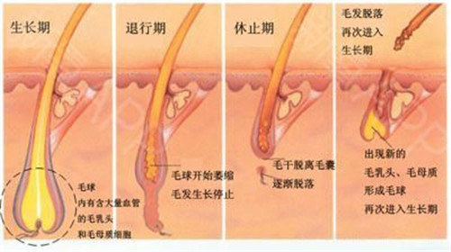 长沙光子脱腋毛费用多少钱呢？