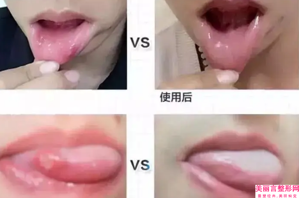 晋城市红蓝光祛痘医院综合实力top10强排名各个口碑佳-晋城修形美林医疗美容门诊部夺得前三