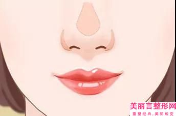 来宾市鼻隔弯曲治疗医院上榜名单前十强名单2023版-来宾古汀医疗美容门诊部公立私立pk详情