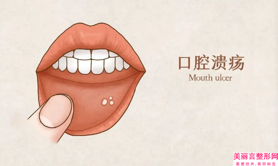 吕梁唇部修复整形后效果有多久呢