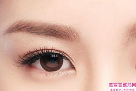 中国上眼睑去脂手术医院排行榜：上眼睑去脂手术医院50强选哪家