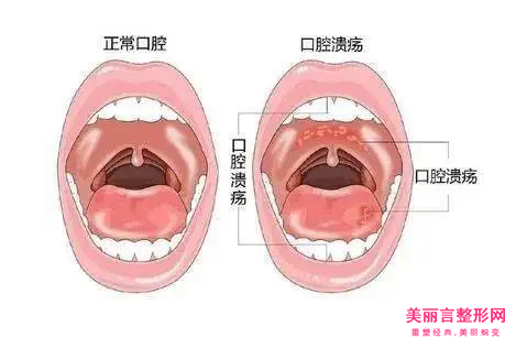 毕节市厚唇改薄术医生在榜名单前十跟踪发布-毕节市厚唇改薄术整形医生