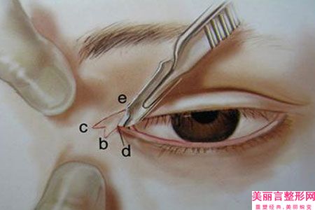 中国regesi再生硅眼部修复医院哪家好：regesi再生硅眼部修复医院前50佳详情