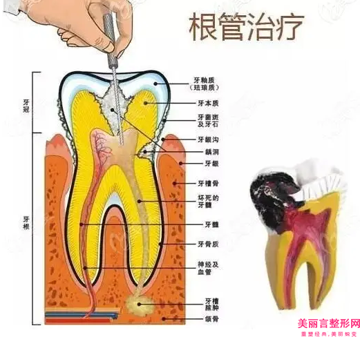 牙齿松动固齿手术会有的后遗症有哪些