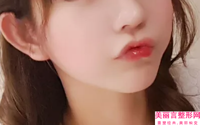 中国整形厚唇改薄术医院哪家口碑好：整形厚唇改薄术医院top50榜单大分享