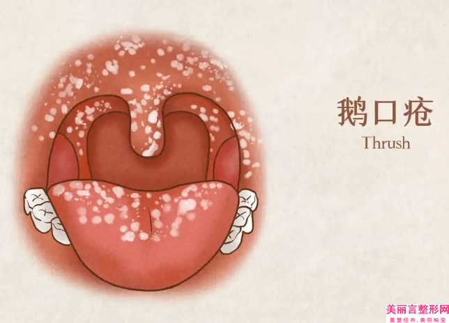 宜宾市喷砂深度洗牙牙科哪家好-宜宾雅美口腔诊所口碑热评