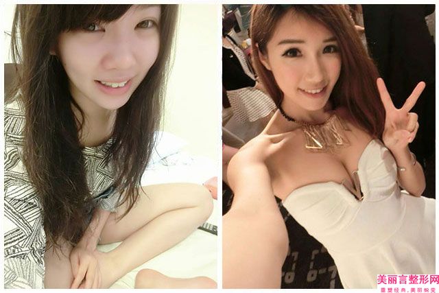 厦门第一医院整形科价格(收费标准)优惠重磅上线-陈益铭医生,郭亮医生介绍