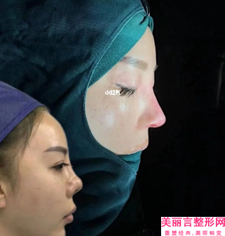 广州紫馨医疗美容门诊部是正规的吗-做鼻子整型手术价格收费表2025在线预览