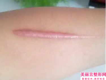 濮阳油田总医院烧伤整形科,濮阳第三人民医院整形科哪家便宜又好