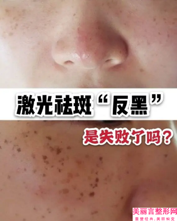 内江市美容院祛斑祛痘印医生上榜名单TOP10强榜尽在这里-李果医生口碑多方面盘点