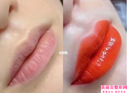 聊城市乳头过大手术医生排名榜_七位供大位挑选（刘艳艳医生值得关注）