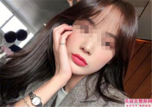 点阵激光祛痘印是真的有效用吗？阅读完此文案例展示你就知道了