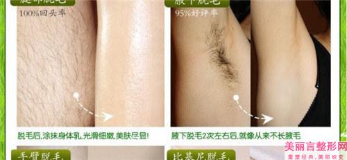 鼻缺损修复手术是否会出现发肿的情况